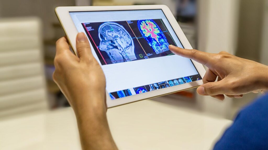 Tablet displaying brain activity scan